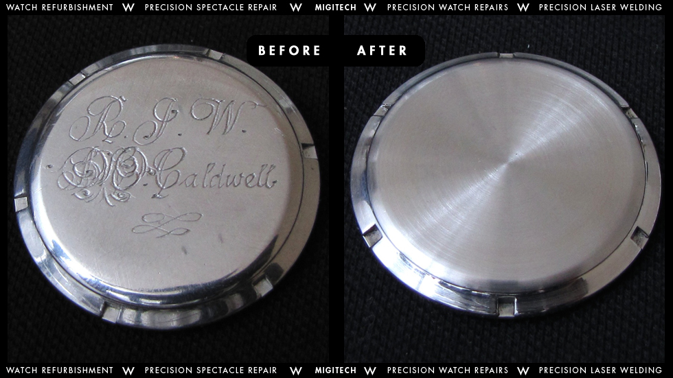 Migitech Engraving Removal