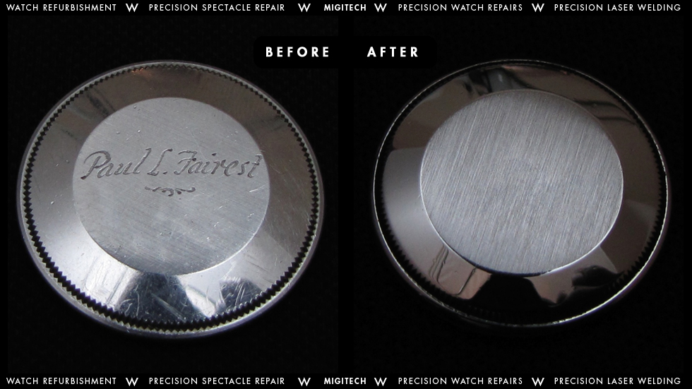 Migitech Engraving Removal